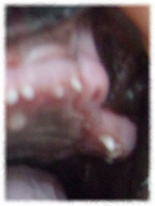 �A�g�X���L�摜